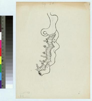 Ensemble de neuf planches dessinées par Veillard relatives à l'opération chirurgicale concernant l'oesophago-jéjuno-gastrostomose. Cette opération a été réalisée pour la première fois en 1906 par le Professeur César Roux sur Florian Gottardi, patient d…