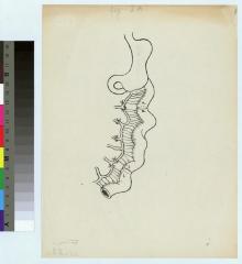 Ensemble de neuf planches dessinées par Veillard relatives à l'opération chirurgicale concernant l'oesophago-jéjuno-gastrostomose. Cette opération a été réalisée pour la première fois en 1906 par le Professeur César Roux sur Florian Gottardi, patient d…