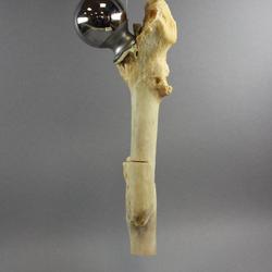 Santé publique: lutte contre la tuberculose (LVT), cure préventive de soleil et de gymnastique de Begnins.